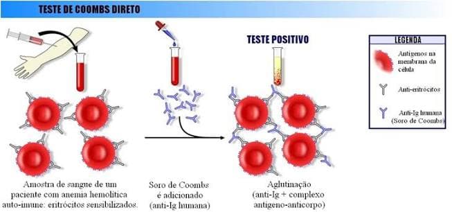 Teste de Coombs