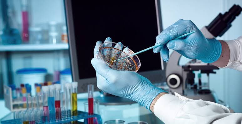 Cultura Bacteriológica