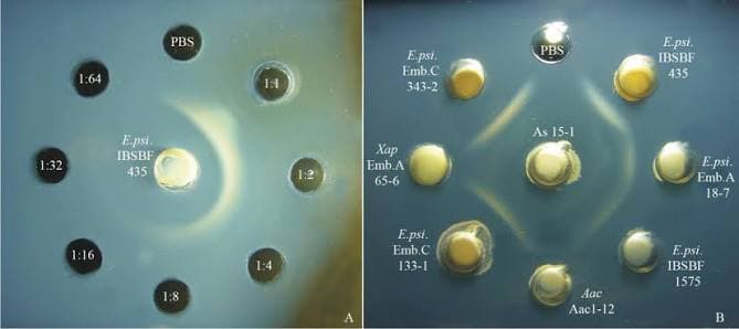 Imunodifusão em Gel de Agarose (IDGA)