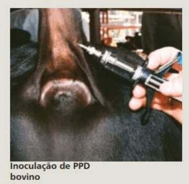 Teste da Prega Caudal (TPC)